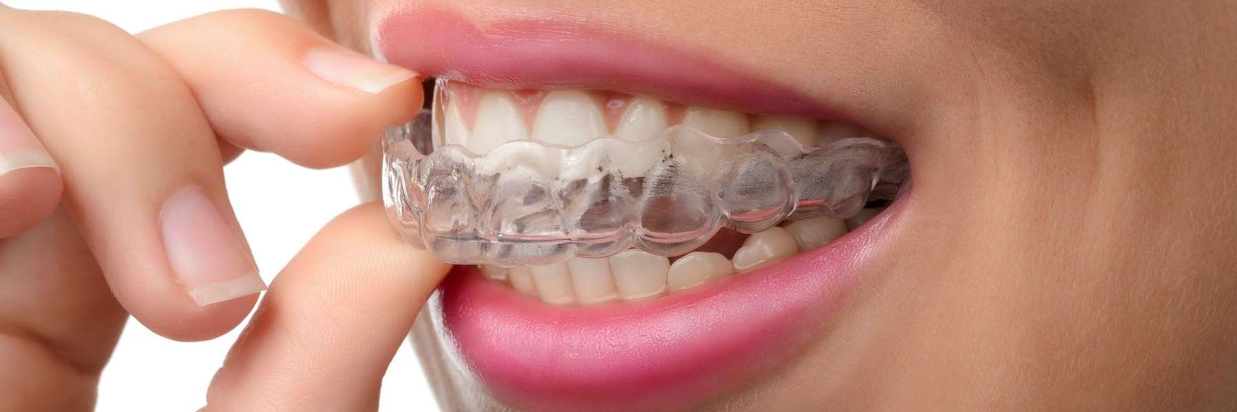 A woman exploring Invisalign® in Maple Ridge, BC