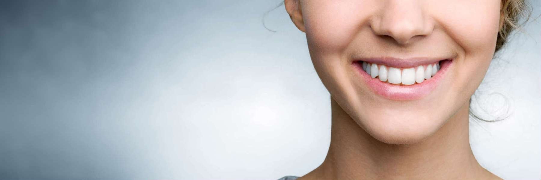 A woman smiling after getting a Dental Crown Services in Maple Ridge, BC